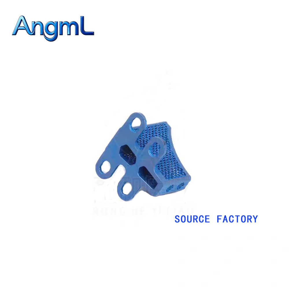 3D Printing Orthopedics - Placa de Gaiola TTA Impressa em